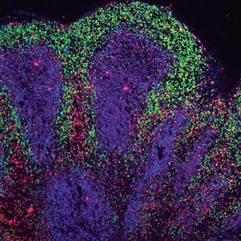 Image for Lab-grown ‘mini brains’ hint at treatments for neurodegenerative diseases