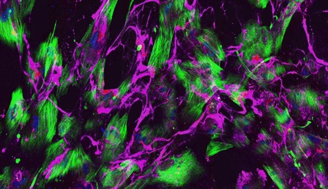 Image for Lab-grown ‘small blood vessels’ point to potential treatment for major cause of stroke and vascular dementia