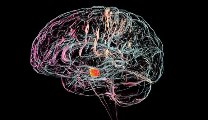 Image for Cambridge researchers are developing implants that could help repair the brain pathways damaged by Parkinson’s disease.